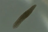 Tiny worms found in ponds and river could help treat schizophrenia