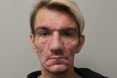Police suspect hundreds may be victims of rapist who transmitted STIs