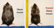 New drug causes ‘complete loss’ of gained weight without side effects