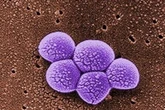 ‘Avoid sharing towels and razors’ amid rise in MRSA superbug cases