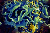 Man ‘cured’ of HIV after brother found to carry rare genetic mutation