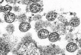 New research suggests when very first Covid case happened
