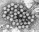 Norovirus is back in full force as cases surge in US