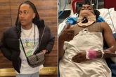‘Love Island USA’ star hospitalized after being trampled by horse