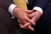 Trump’s hand makeup is back during Scotland trip