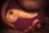 Promising drug found to double survival rate for pancreatic cancer