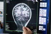 Coma patients may experience fleeting consciousness right before death