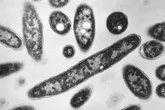 One dead and 22 sick from Legionnaires’ cluster in New York: officials