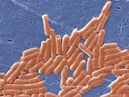 Deli meats cause widespread salmonella outbreak across 14 states