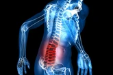 Just one course of psychotherapy can ease back pain for years