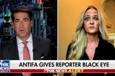 MAGA journalist says ‘antifa-affiliated’ protester gave her black eye