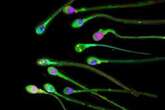 New research discovers sluggish sperm can be boosted by ultrasound waves