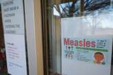 First death from measles in Texas outbreak that has sickened over 100