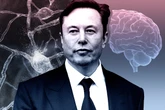 Elon Musk wants to fit millions of people with Neuralink brain chip