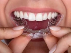 SmileDirectClub ‘left people with crooked teeth’ after firm collapse