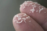 Scientists issue new warning linking microplastics with strokes