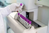 Scientists discover new, rare blood type during routine test