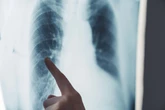 Radiographer suspended after hoping colleague ‘has a brain tumour’