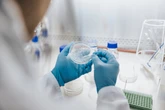 Warning over killer fungus which could infect millions as it spreads