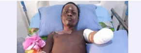 Taraba Poly student loses both hands after electrocution while hoisting PDP flag