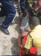 Woman suffers fractures as hit-and-run driver escapes in Lagos — LASTMA