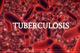 We relegated Tuberculosis diagnosis, treatment – Bauchi govt pledges more funding