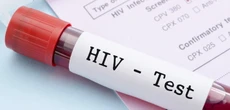 ABSACA raises concern over HIV infection rates in three Abia LGs
