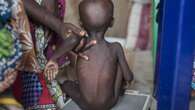 Hardship: Nigerian govt confirms over 4m children malnourished in Northeast, Northwest