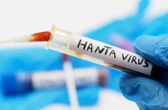 Hantavirus : un Américain testé positif, annonce le ministère de la Santé