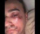 Un candidat de « Qui veut épouser mon fils ? » victime d’une agression homophobe à Paris