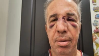 VIDÉO. « La prochaine fois, ce sera quoi ? » : agressé par un patient, ce médecin songe à fermer son cabinet