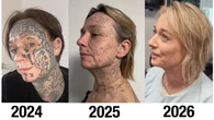 Son ex-compagnon l’avait forcée à se tatouer son nom plus de 250 fois sur le corps et le visage, elle milite désormais pour le détatouage