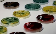 « Helicobacter pylori » : c’est quoi cette bactérie qui pourrait causer des millions de cancers de l’estomac dans les décennies à venir ?