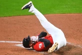 Base-ball : multiples fractures faciales pour un joueur de MLB, après avoir reçu une balle à 160 km/h en pleine tête