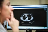 Dépistage du cancer du poumon après 50 ans, c’est parti : voici comment participer