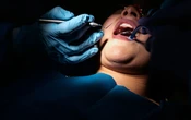 Bouches massacrées, surfacturations… Enquête sur un faux dentiste des beaux quartiers