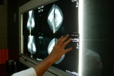Les cancers et maladies cardiovasculaires restent les premières causes de décès en France