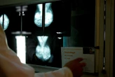 La prise en charge des soins liés au cancer du sein se fait attendre, une pétition lancée
