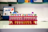 Leur père meurt dans les toilettes pendant un prélèvement d’urine, l’hôpital de Barcelone met deux jours à s’en rendre compte