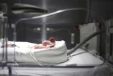 « Une petite sirène » : Eliana, un bébé prématuré, guérie d’une blessure grâce à une greffe de peau de poisson