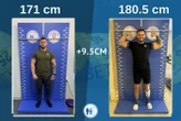 VIDÉO. « Vous voulez être plus grand ? » : des opérations pour grandir en se faisant casser les os des jambes