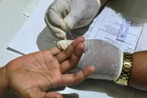« Comme une trainée de poudre » : une inquiétante épidémie de VIH se propage sur les îles Fidji