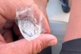 « Du pur génie » : le client d’un hôtel saupoudre des serviettes de poil à gratter pour empêcher le monopole des meilleurs transats