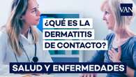 Dermatitis de contacto: síntomas y opciones para tratarla