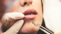 Sanidad alerta del uso ilegal de inyecciones de hialuronidasa en operaciones estéticas