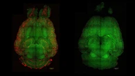 Logran revertir el alzheimer en ratones con solo tres inyecciones de nanopartículas