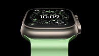 Los Apple Watch pueden detectar la hipertensión, pero aún no se les permite hacerlo