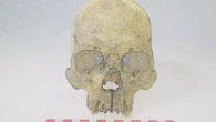 Huesos humanos de hace 4.000 años señalan que una rara forma de lepra infectó a personas en América antes de la llegada de los europeos