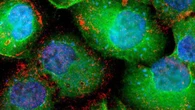 Revolución en oncología: los tratamientos triplican la esperanza de vida con cáncer de próstata avanzado