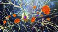 Perder la pareja o el empleo se relaciona con cambios en el cerebro asociados al alzheimer